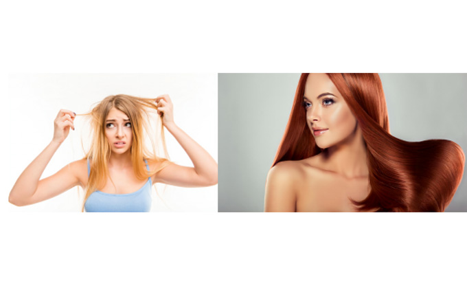 Dietary Supplement For Hair Growth