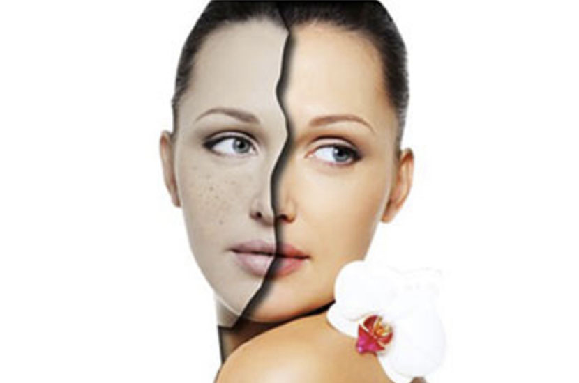 The effect of lightening and removing spots