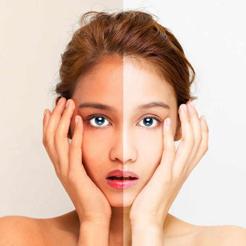 Whitening Ingredients